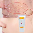 Peeling Gesichtsreiniger Peeling Creme Whitening Face Scrub 2019 Gel D3D6
