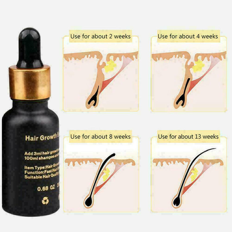 20Ml Natural Hair Growth Serum Essence Oil Hair Fiber Faster best Grow Hair D9C0