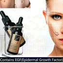 Lavender Essence Skin Care Natural Pure Remove Ance Mark Burn Strentch Remo H0D9