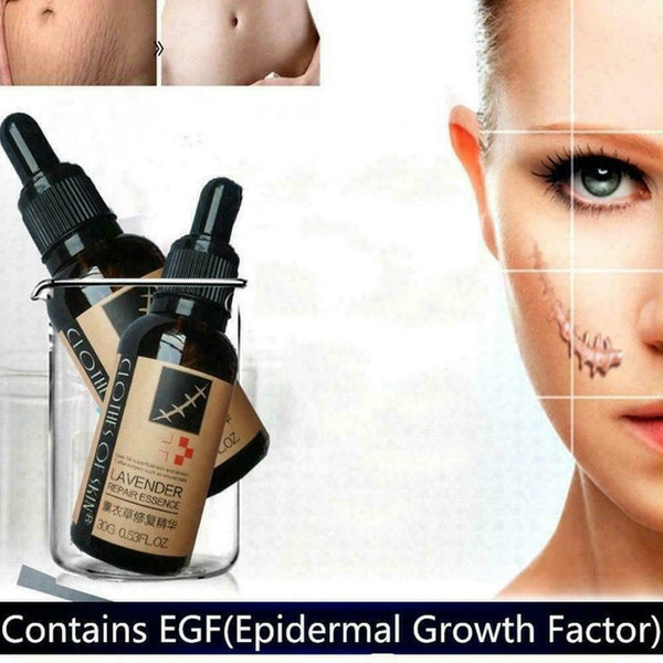 Lavender Essence Skin Care Natural Pure Remove Ance Mark Burn Strentch Remo H0D9
