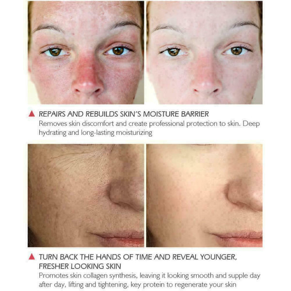 Face Serum AntiWrinkle Facial Essence Whiten Moisturizing Anti-allergy Hydr F2R8