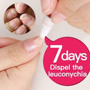 4Pcs Nail Liquid Pen Cuticle Remover Onychomycosis Fungus Nail Liquid Nail Care