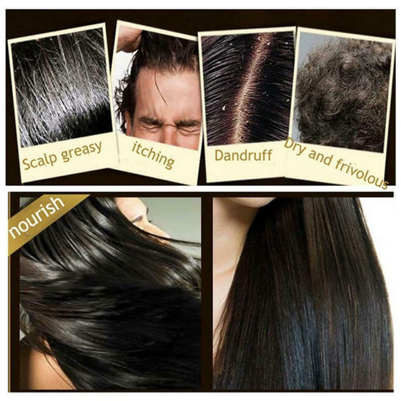 Shampoo Hair Care Ginger Bar Hair Growth Hair Care Moisturizes Shampoo 200ml