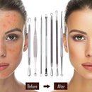 Blackhead Remover | Pimple Extraction Blemish Suction Removal Tools Kit