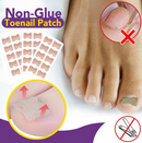 50 sheets Non-Glue Toenail Patch Ingrown Toenail Correction Pedicure Tools
