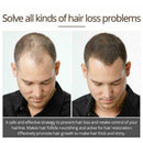 Hair Growth Essence Essential Oil Liquid Spray Nourish Shiny Thick Roots Pr O4G6