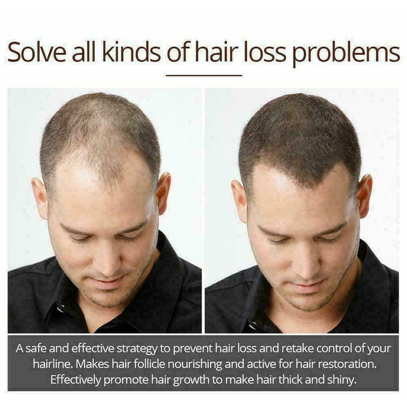 Hair Growth Essence Essential Oil Liquid Spray Nourish Shiny Thick Roots Pr O4G6