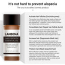 20ml Fast Powerful Hair Growth Care Essential Oil Liquid Hair Loss Treatme QMJ