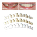 Tooth Kit DELUXE 3 SHADES of Temporary Teeth Included Super C3O5 K0R8 S8J7