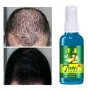 30ML Fast Hair Growth Essence Ginger Liquid Hair Loss Hair Care Treatment I2W8