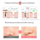 Fully Electric Electric Blackhead Remover Vacuum Pore Cleaner Facial Exfoli