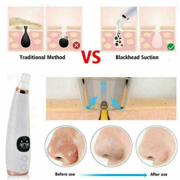 Blackhead Remover Vacuum Suction Facial Acne Pore Cleaner Extractor O1U6 Fo Y7O1