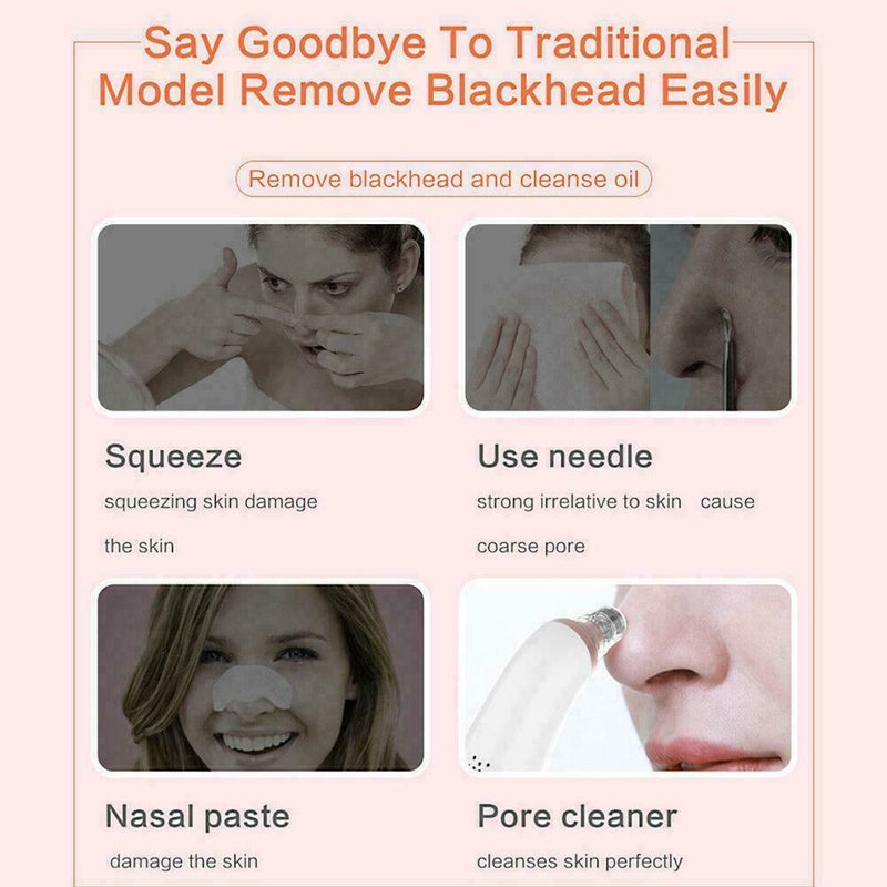 Electric Facial Skin Care Pore Blackhead Remover Cleaner Acne Vacuum Sucker O6J5