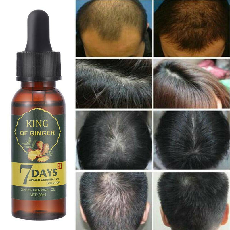 7 Day Ginger Germinal Hair Growth Serum Hairdressing Loss Treatement Oil US