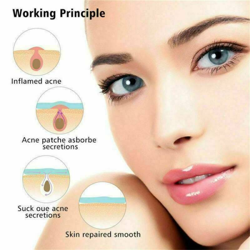 Pack of 36Pcs Invisible Acne Patch Anti Pimple Stickers Spot Scar Care Treatment