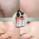 Pore Shrinking Essence Tightening Oil-control Moisturizing HOT Remover Blac O7H4