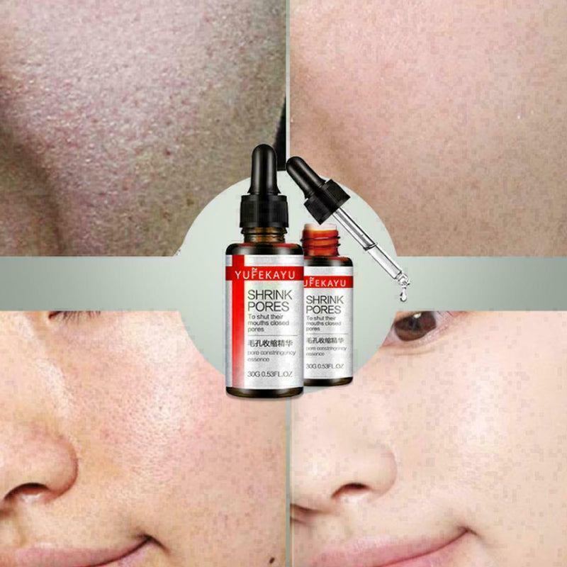 Pore Shrinking Essence Tightening Oil-control Moisturizing HOT Remover Blac O7H4