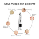 Electric Blackhead Pores Acne Clean Surface Instrument Beauty Cleaner Tools
