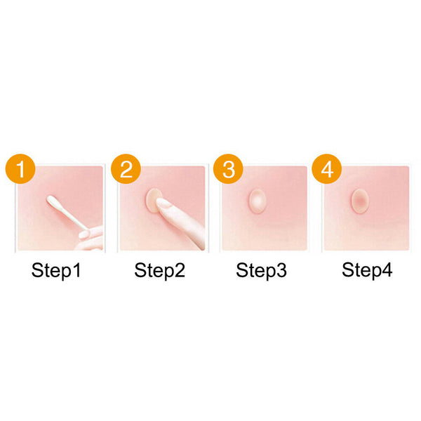 Universal Acne Absorbing Cover Heal Skin Blemish Spot Acne Stickers 30 Dots V3