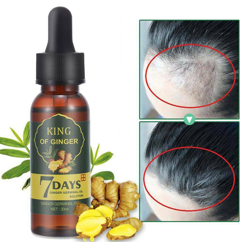 7 Days Hair Growth Products Men Women Natural Oil Serum Grow Fast Treatment New