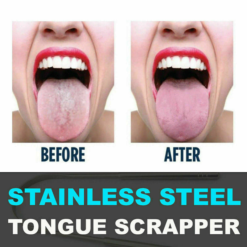 Stainless Steel Metal Tongue Scraper Cleaner For Bad Oral Breath Tool Cle H U8W1