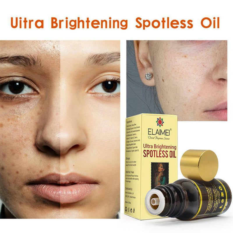 Rose Brightening Spotless Oil Skin Care Natural Pure Remove Dark Spots 10ML