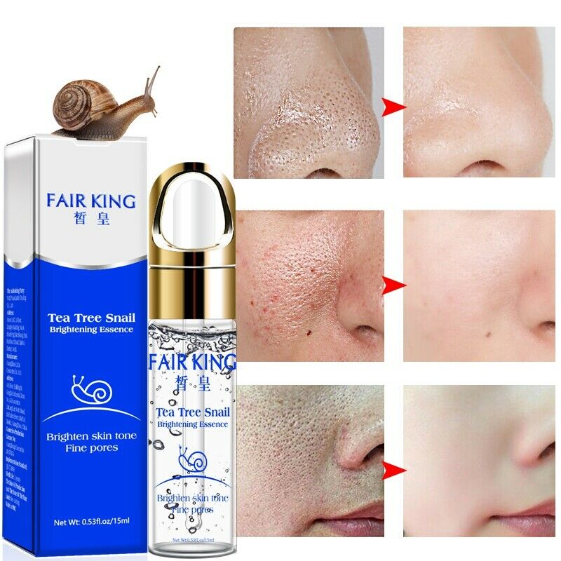 Fair King Tea Tree Hyaluronic Acid Snail Plant Extract Face Serum Whitening W5H6