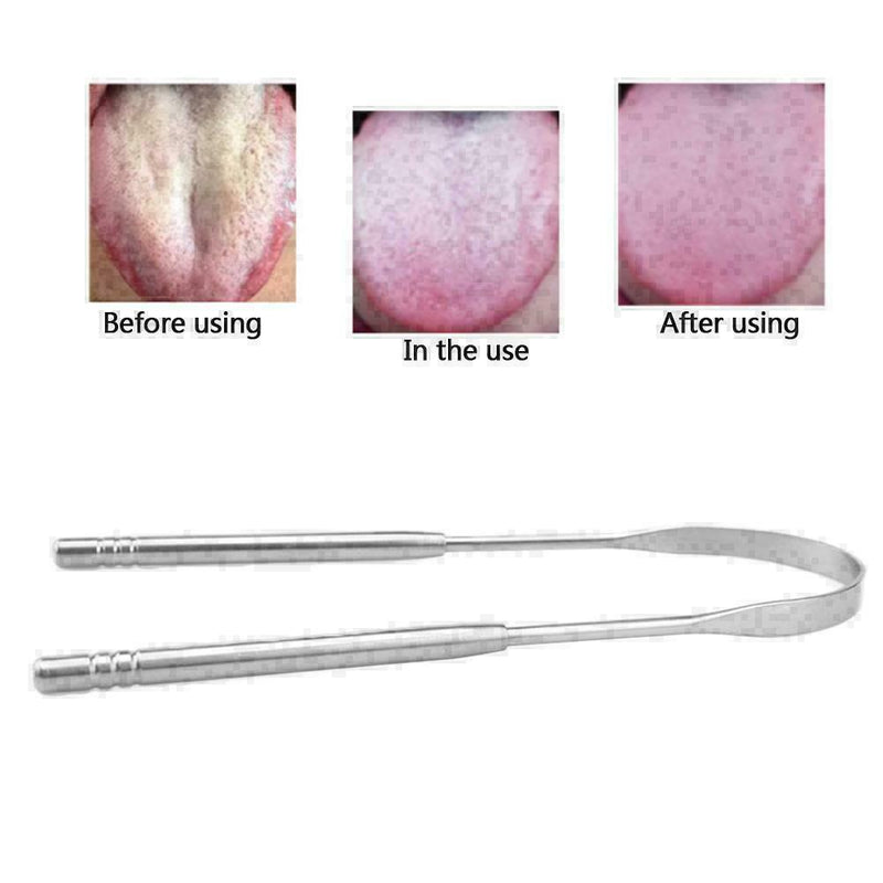 Stainless Steel Tongue Cleaner Scraper Oral Hygiene Bad Breath Care Health V4L1