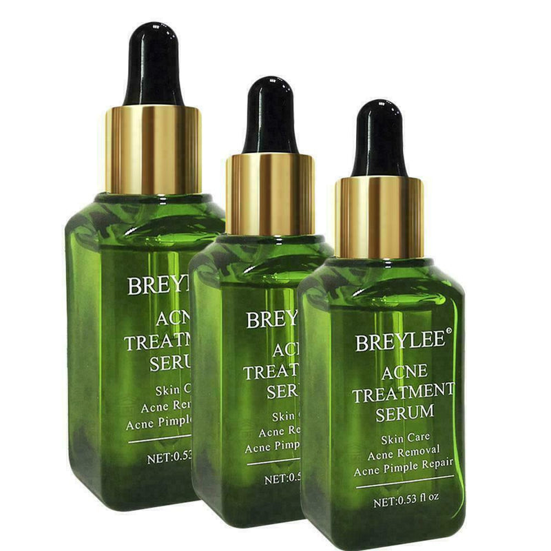 Shrink Pores Essence Facial Serum Blackhead Acne Face Essence Oil E5A0 O3W0