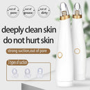 Electric Blackhead Remover Pore Vacuum Suction Dermabrasion Face Cleaner OZ