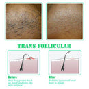 Exfoliating Brush Body Brush Eliminate Shaving Irritation For Face Neck Arm