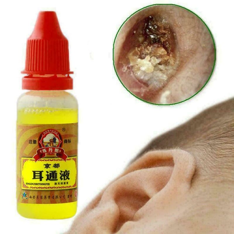 Ear Acute Otitis Drops Chinese Herbal Medicine For Ears Deafness Tinnitus S Z9R5