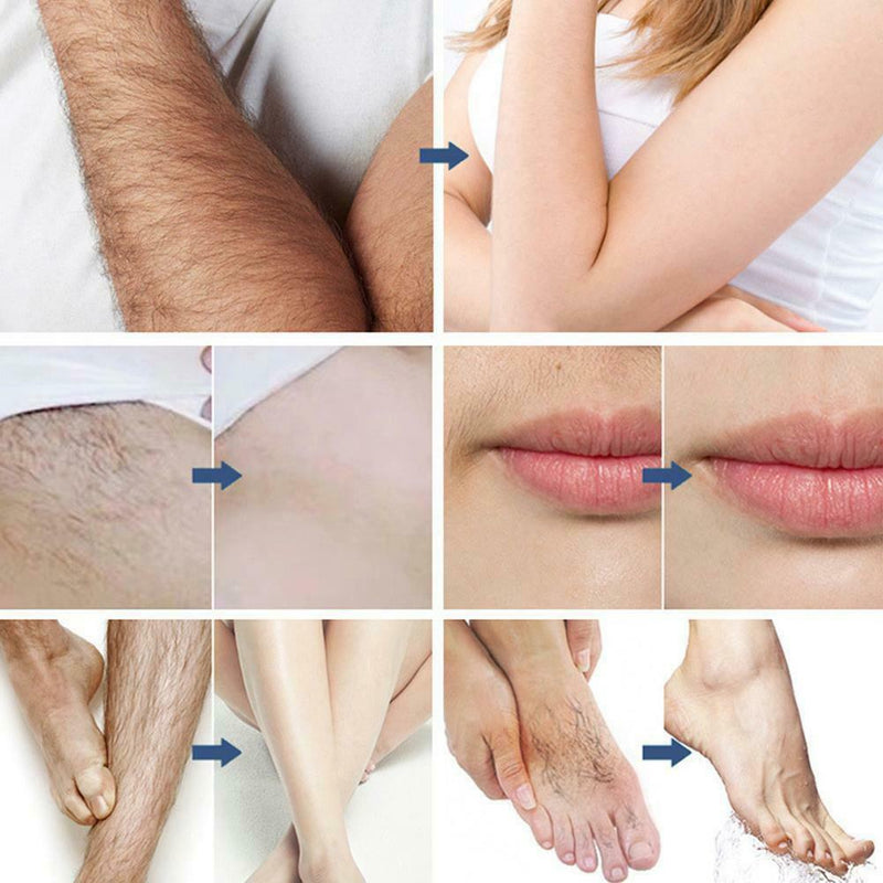 Herbal Hair Removal Spray Painless Underarm Leg Public Hair Body Facial Hai 30ML