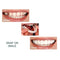 1Pair Teeth Veneers Perfect Smile Cosmetic Comfort Covers Upper Bottom BX