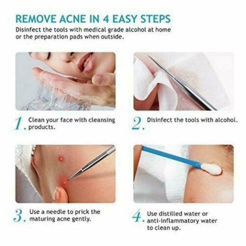 Blackhead Remover | Pimple Extraction Blemish Suction Removal Tools Kit