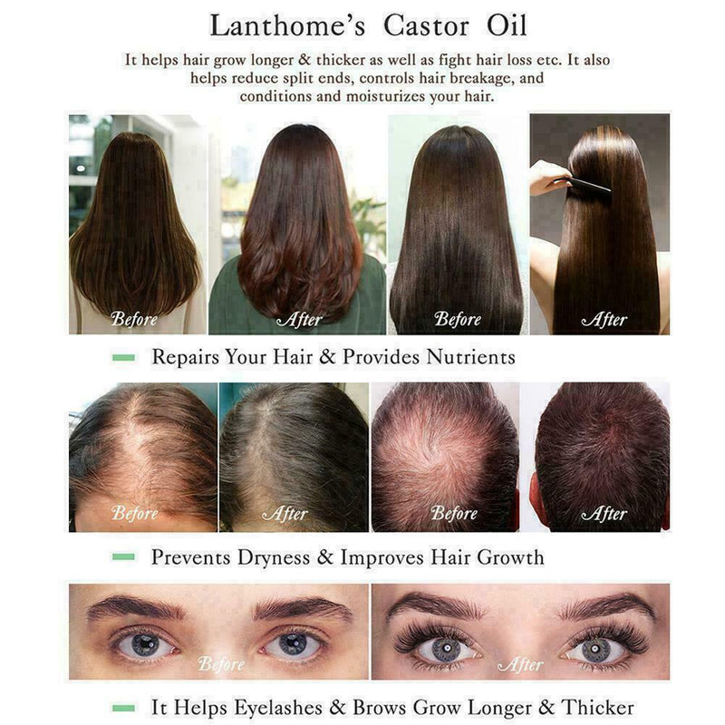 10ml Organic Castor Oil For Hair Growth Eyebrows & Eyelashes (included brus W5Q5