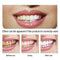Cleaning Teeth Whitening Removes Plaque Stains for 10ml Tools Oral Hygiene E7B7