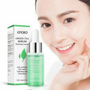 Greenlouch Pore Corset Serum 15ML US