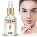 Skin Whitening Lightening Brightening Serum Acid Dark Bleaching Pretty Spot U6V6