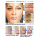 Fair King Tea Tree Hyaluronic Acid Snail Plant Extract Face Serum Whitening W5H6