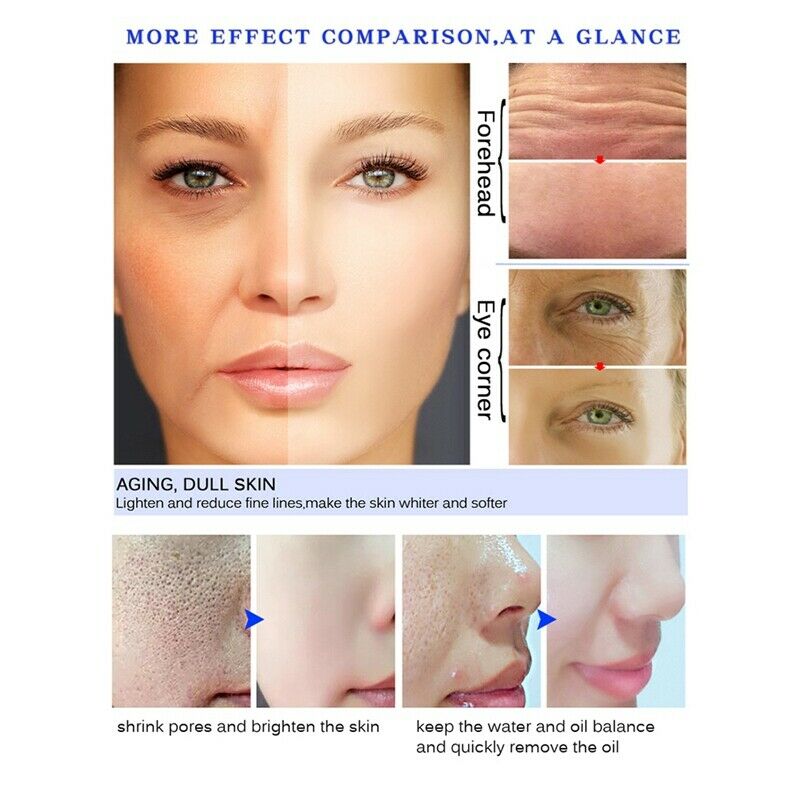 Fair King Tea Tree Hyaluronic Acid Snail Plant Extract Face Serum Whitening W5H6