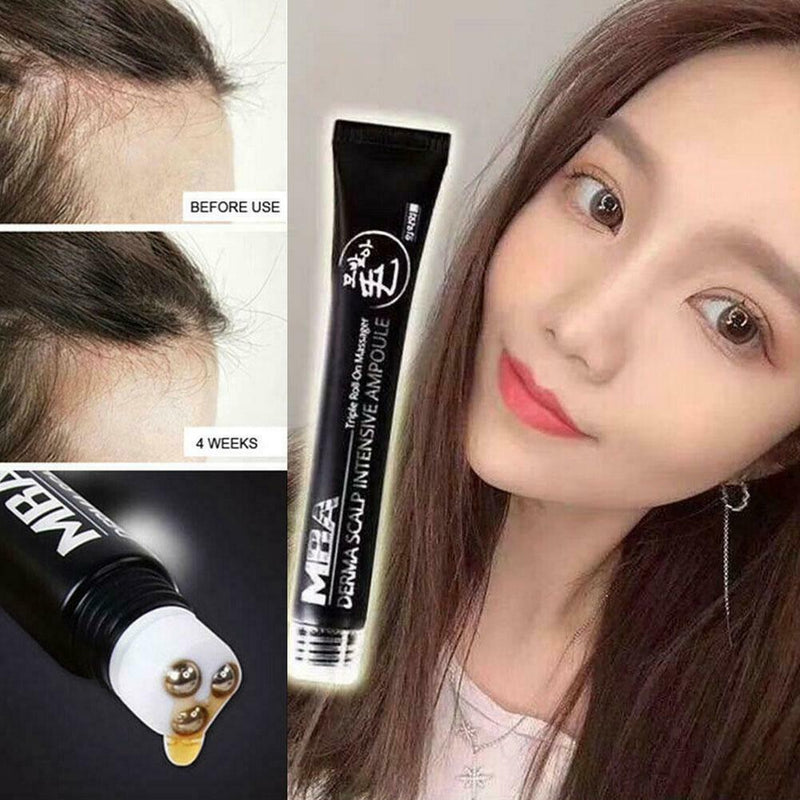20ml Scalp Intens Roll-on Hair Growth Serum Hair Growth Hair Loss Essence