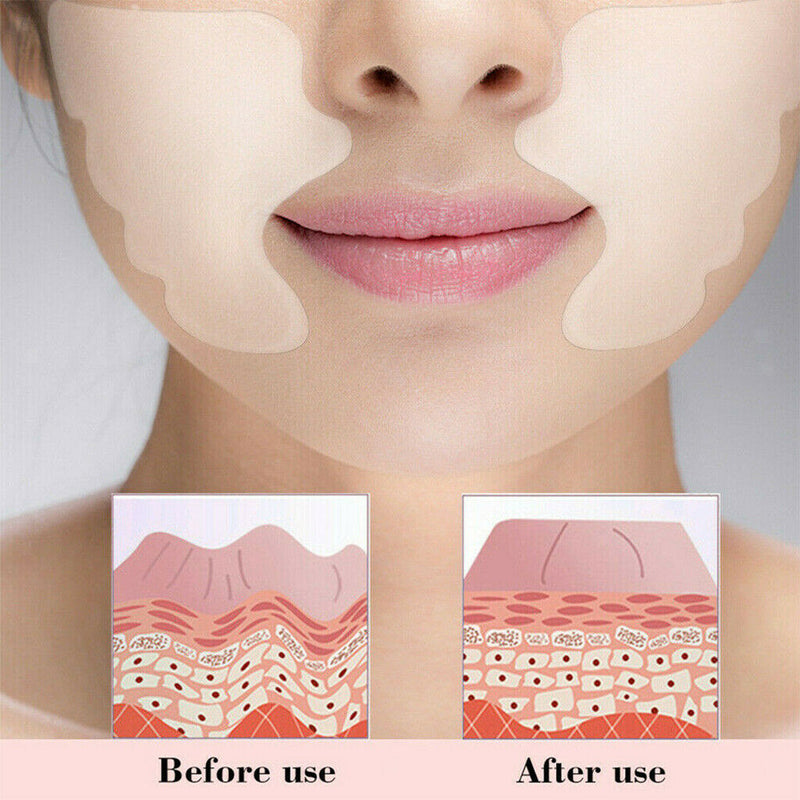 2pcs Silicone Pads Stickers for Cheek Lifting Face Skin Caring Wrinkles Remover