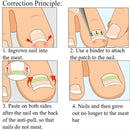 Ingrown Toenail Tool Correction Patch-Ingrown Toenail Lifter and File Ingrown
