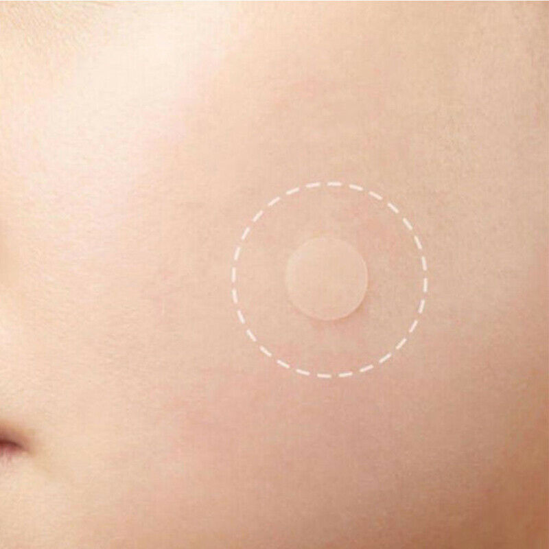 36PCS Fast Remover Pimple Patch Treatment Acne Patch Skin Tag Beauty Makeup  Nw
