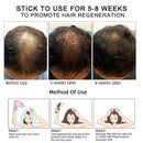 Hair Revitalizing Serum Ginger Fast Growth Essential Anti Preventing Oil L4T4