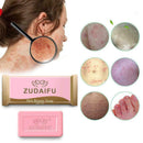 Sulfur Soap Skin Conditions Fungus Bath whitening soap N7O7 shampoo Portabl P2V4