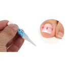 Nail Glue Ingrown Toenail Correction Pedicure Toe Patch Adhesive Foot Care  N2T9