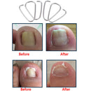6Pcs Ingrown Toe Nail Correction Hook Fixer Pedicure Tool Toenail Care Correcto@