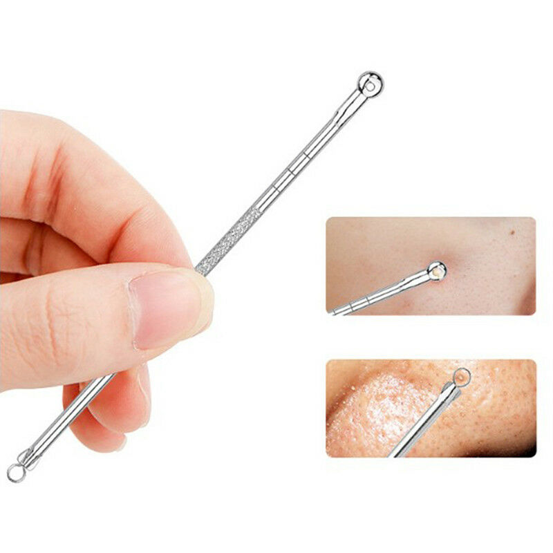 5x Blackhead Comedone Acne Blemish Remover Stainless Needles Remove Tool Kit Gw